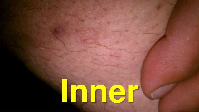 Master keith fisting Free amateur facial cumshot videos latina